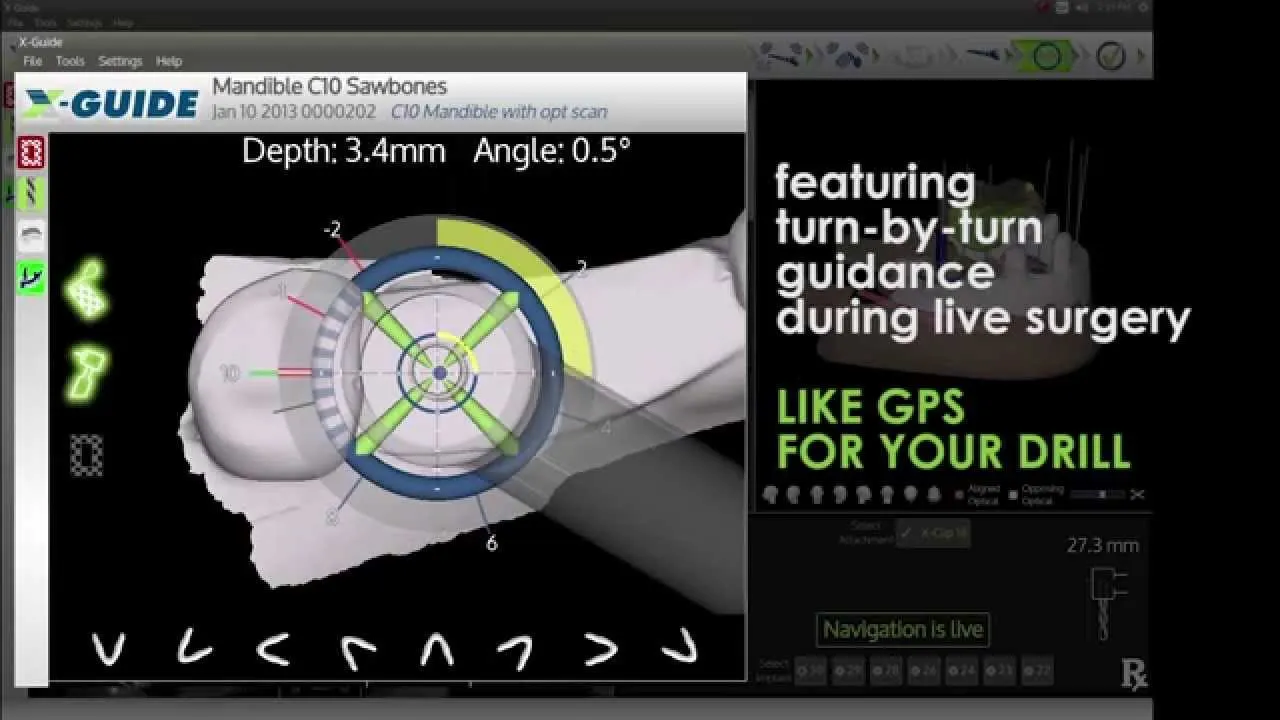 Intro Demo for the X-Guide Dynamic 3D Navigation System